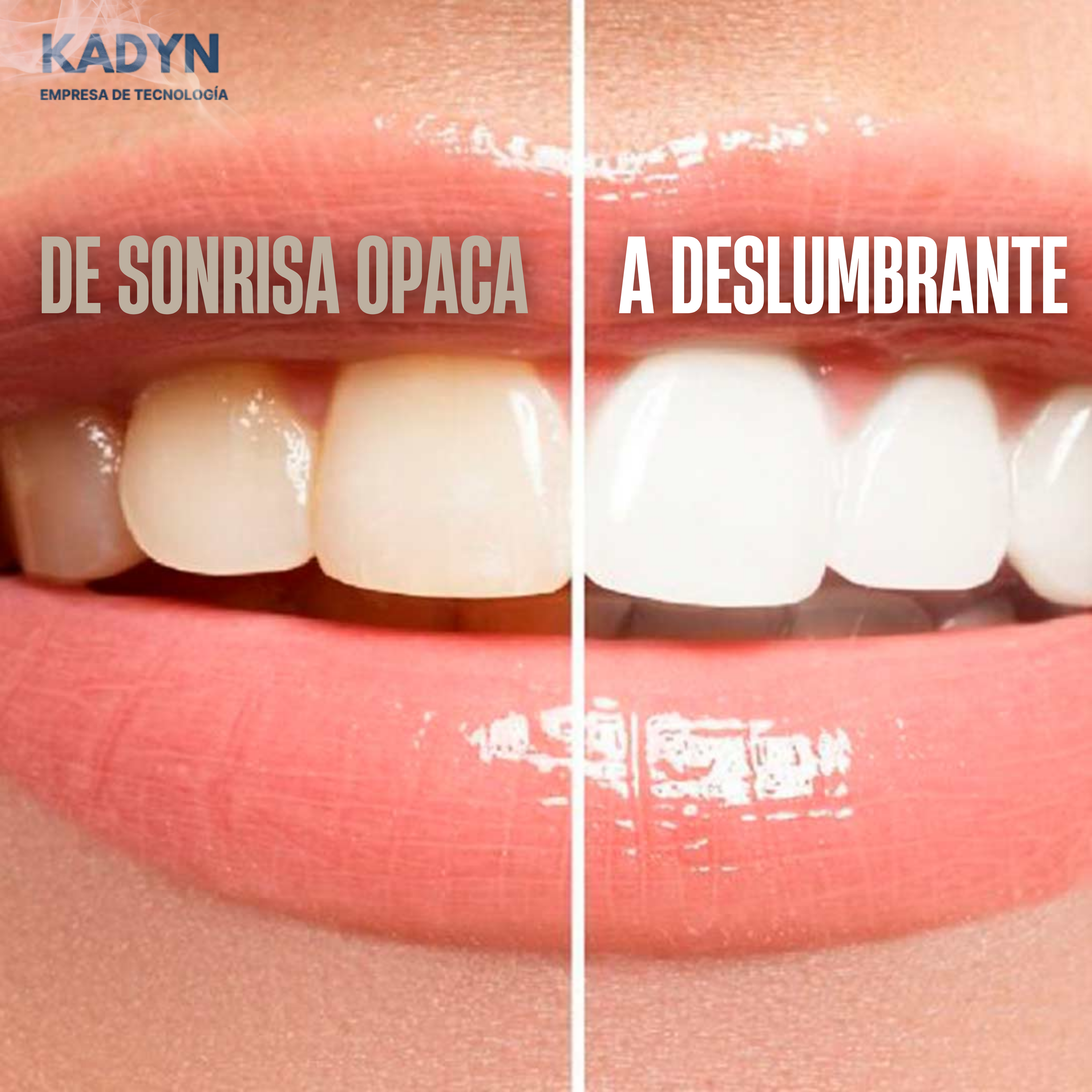 IRRIGACLEAN™ Triple Acción Max 😁🦷 Donde el cepillo no llega….                                                 Bluexpress | Starken | Todo CL.    🏠🚚📦 👇🏻👇🏻