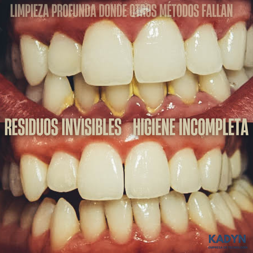 IrrigaClean™ Triple Acción Max / ¡NUEVA OFERTA LIMITADA! 🌎
